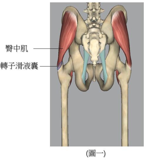 轉子疼痛症候群 (Trochanteric pain syndrome)